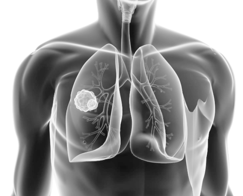 Data Science Health Prediction Model (SVR)
